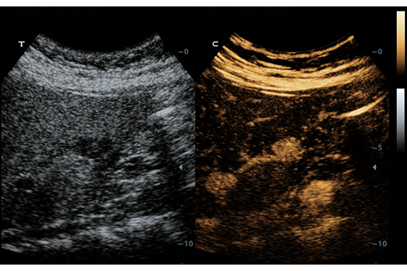 Mindray DC-60 Exp X-Insight