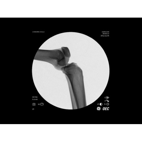 Моноблочный рентгенохирургический аппарат GE Brivo OEC 785/865